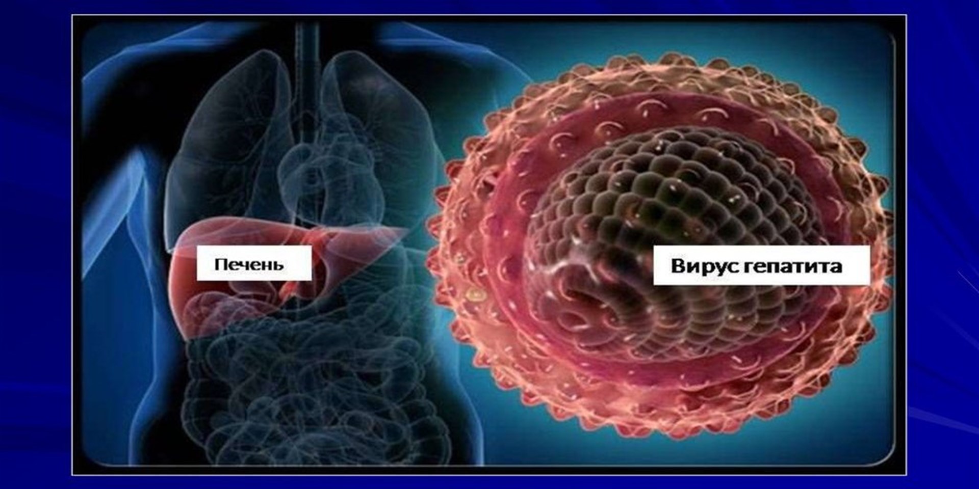 14.03.2020 Анонс! Три шага к будущему без гепатита С