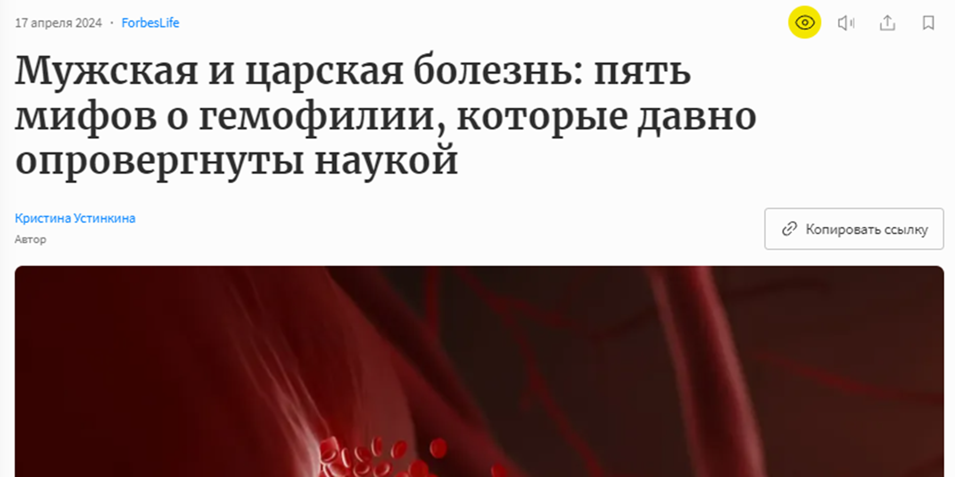 Мужская и царская болезнь: пять мифов о гемофилии, которые давно опровергнуты наукой